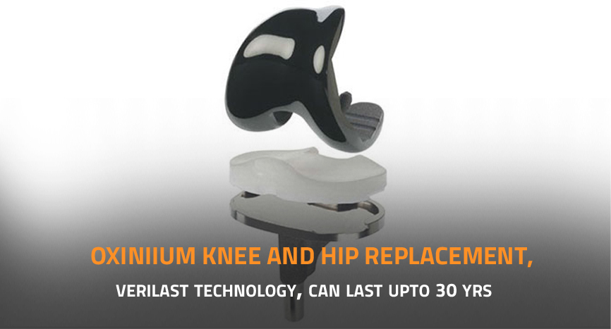 Robotic Knee Replacement Surgery